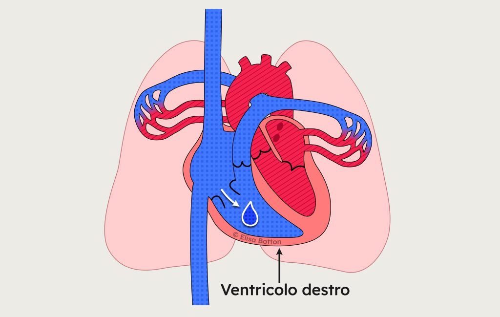 Ventricolo destro del cuore durante il riempimento con sangue proveniente dall’atrio destro.
