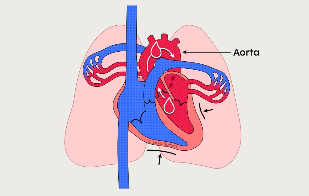 Aorta e ventricolo sinistro durante la fase di espulsione del sangue ossigenato.